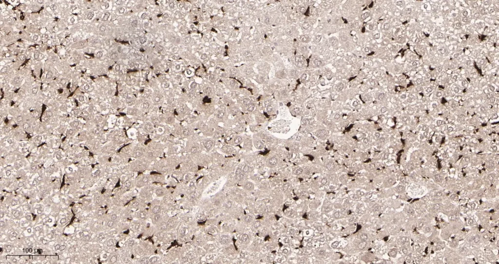 Immunohistochemical analysis of paraffin-embedded Mouse liver tissue. 1, Iba1 Rabbit Monoclonal Antibody was diluted at 1:200(4°C,overnight). 2, EDTA pH 9.0 was used for antibody retrieval(>98°C,20min). 3,Secondary antibody was diluted at 1:200(room temperature, 30min).