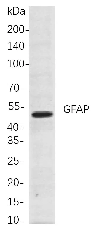 Western blot analysis of lysates from Mouse brain cells, using GFAP Rabbit mAb. The HRP-conjugated Goat anti-Rabbit IgG antibody was used to detect the antibody.