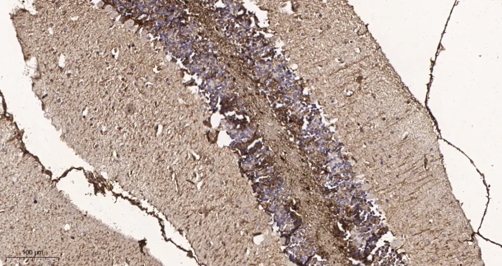 Immunohistochemical analysis of paraffin-embedded Mouse brain tissue. 1, GFAP Rabbit Monoclonal Antibody was diluted at 1:200(4°C,overnight). 2, EDTA pH 9.0 was used for antibody retrieval(>98°C,20min). 3,Secondary antibody was diluted at 1:200(room temperature, 30min).