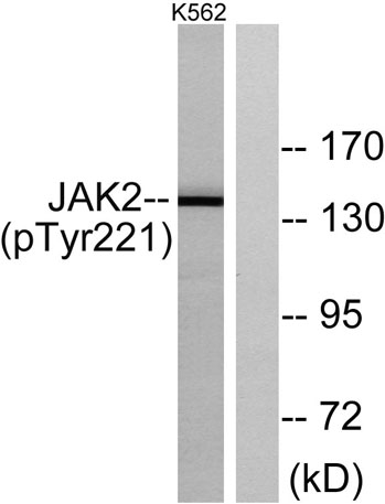Western blot analysis of lysates from K562 cells, using JAK2 (Phospho-Tyr221) Antibody. The lane on the right is blocked with the phospho peptide.