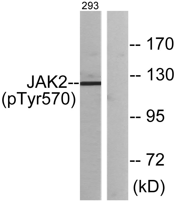 Western blot analysis of lysates from 293 cells treated with etoposide 25uM 24h, using JAK2 （Phospho-Tyr570） Antibody. The lane on the right is blocked with the phospho peptide.