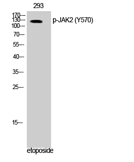 Western Blot analysis of 293 cells using Phospho-JAK2 （Y570） Polyclonal Antibody