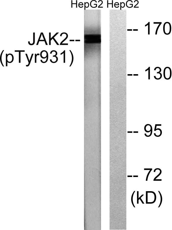 Western blot analysis of lysates from HepG2 cells treated with Na3VO4 0.3mM 40', using JAK2 （Phospho-Tyr931） Antibody. The lane on the right is blocked with the phospho peptide.