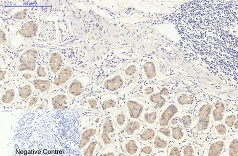 Immunohistochemistry analysis of paraffin-embedded Human stomach tissue using DDIT3 (7G7) antibody.High-pressure and temperature Sodium Citrate pH 6.0 was used for antigen retrieval.Negative control was used by secondary antibody only.