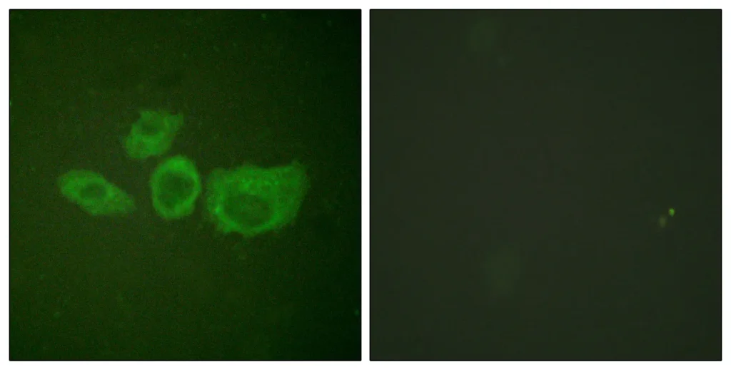 Immunofluorescence analysis of HUVEC cells, using Tyrosine Hydroxylase Antibody. The picture on the right is blocked with the synthesized peptide.