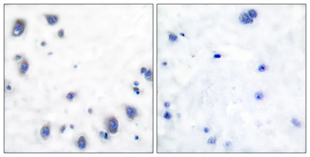 Immunohistochemistry analysis of paraffin-embedded human brain tissue, using Tyrosine Hydroxylase Antibody. The picture on the right is blocked with the synthesized peptide.
