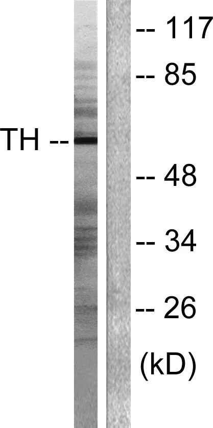 Western blot analysis of lysates from NIH/3T3 cells, treated with Forskolin 40nM 30‘, using Tyrosine Hydroxylase Antibody. The lane on the right is blocked with the synthesized peptide