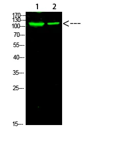 Western Blot analysis of 1,mouse-heart 2,mouse-brain cells using PARP-1 (AcetylK521) Rabbit Polyclonal Antibody diluted at 1:1000（4°C overnight）. Secondary antibody：Goat Anti-rabbit IgG IRDye 800diluted at 1:5000, 25°C, 1 hour）