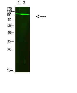 Western Blot analysis of 1,293t 2,mouse-brain cells using PARP-1 (Acetyl-K521) Rabbit Polyclonal Antibody diluted at 1:10004°C overnight. Secondary antibody: Goat Anti-rabbit IgG IRDye 800 (diluted at 1:5000, 25°C, 1 hour）