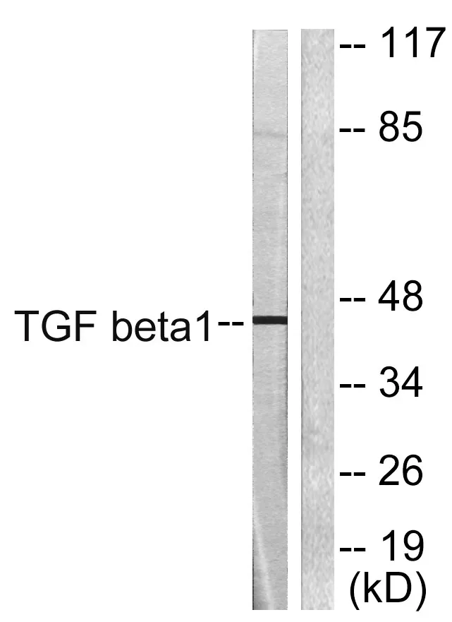 Western blot analysis of lysates from HepG2 cells, using TGF beta1 Antibody. The lane on the right is blocked with the synthesized peptide.