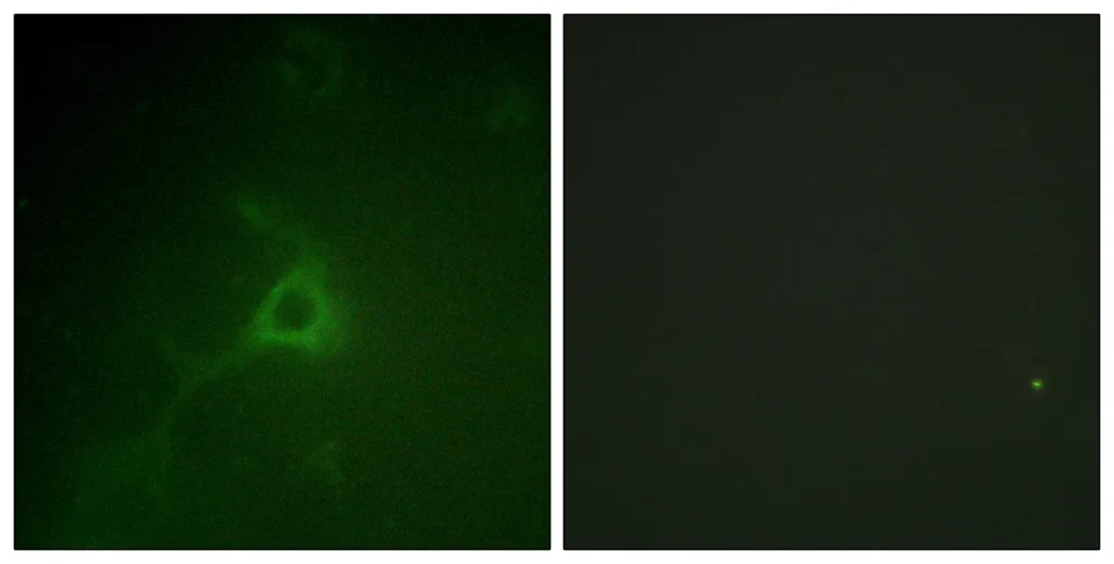 Immunofluorescence analysis of COS7 cells, using GFAP Antibody. The picture on the right is blocked with the synthesized peptide.