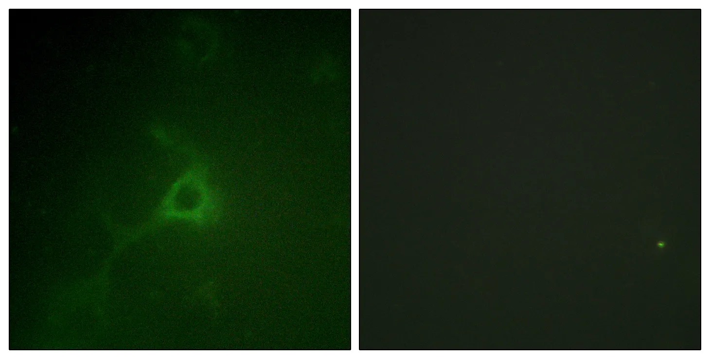 Immunofluorescence analysis of COS7 cells, using GFAP Antibody. The picture on
the right is blocked with the synthesized peptide.