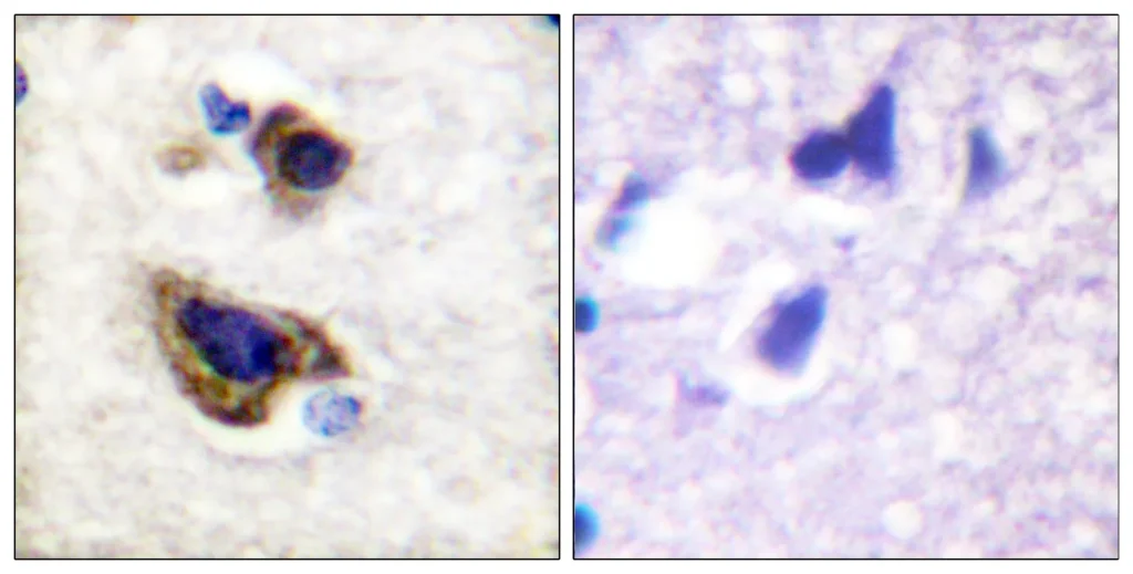 Immunohistochemistry analysis of paraffin-embedded human brain tissue, using GFAP Antibody. The picture on the right is blocked with the synthesized peptide.