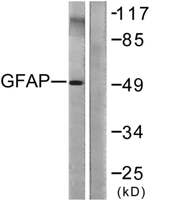 Western blot analysis of lysates from COLO205 cells, using GFAP Antibody. The lane on the right is blocked with the synthesized peptide.