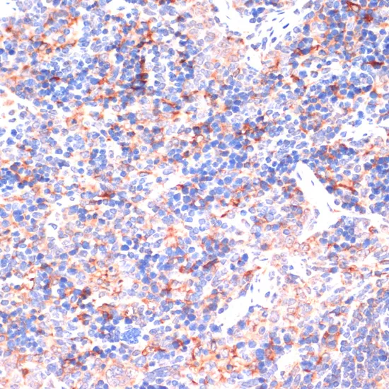Immunohistochemistry analysis of paraffin-embedded mouse spleen using IL-6 antibody. High-pressure and temperature Sodium Citrate pH 6.0 was used for antigen retrieval.