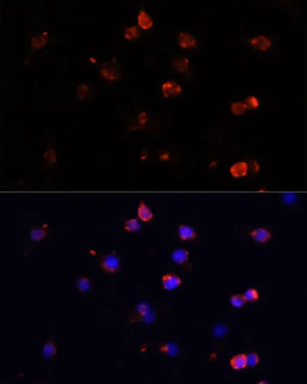 Immunofluorescence analysis of IL-6 in RAW264.7 cells using IL-6 antibody,and DAPI (blue).