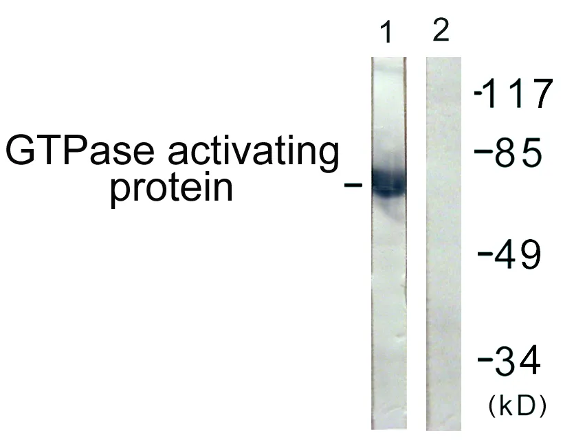 Western blot analysis of lysates from COS7 cells, using GTPase Activating Protein Antibody. The lane on the right is blocked with the synthesized peptide.
