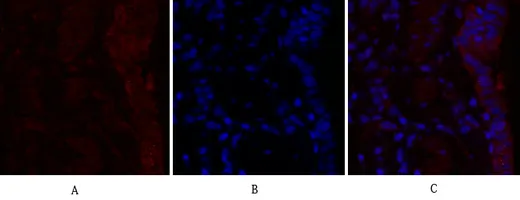 Immunofluorescence analysis of RhoA in rat lung using Rho A antibody(red),and DAPI (blue).