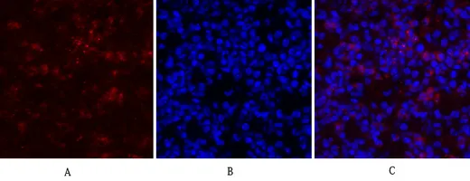 Immunofluorescence analysis of RhoA in mouse lung using Rho A antibody(red),and DAPI (blue)