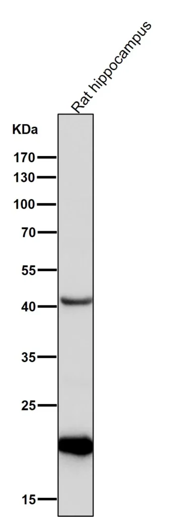 All lanes use the Antibody at 1:2K dilution for 1 hour at room temperature