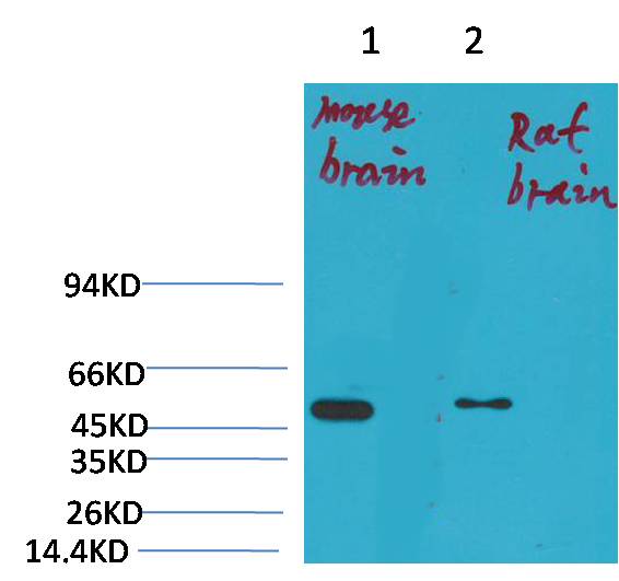 Western blot analysis of 1) Mouse BrainTissue, 2)Rat Brain Tissue with KV1.1 potassium channel Rabbit pAb diluted at 1:2,000.