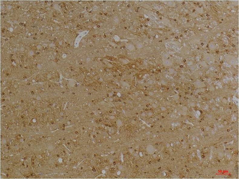 Immunohistochemical analysis of paraffin-embedded Rat BrainTissue using KV1.1 Potassium Channel Rabbit pAb diluted at 1:200.