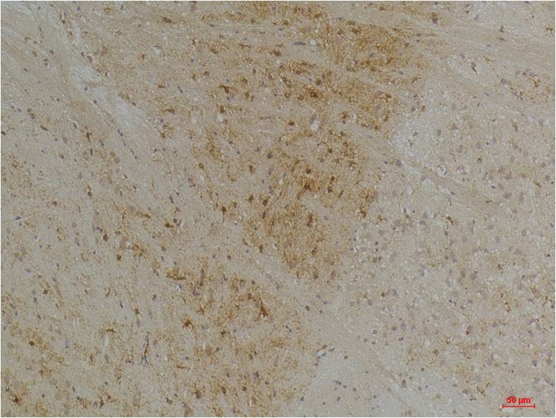 Immunohistochemical analysis of paraffin-embedded Mouse BrainTissue using KV1.1 Potassium Channel Rabbit pAb diluted at 1:200.