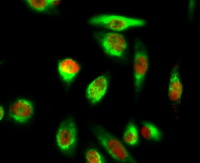 Immunofluorescence analysis of Hela cell. 1,YAP (phospho Ser127) Polyclonal Antibody(red) was diluted at 1:200(4° overnight). β-Tubulin Monoclonal Antibody(5G3)(green) was diluted at 1:200(4° overnight). 2, Goat Anti Rabbit Alexa Fluor 594 Catalog:RS3611