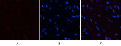 Immunofluorescence analysis of rat-heart tissue. 1,YAP (phospho Ser127) Polyclonal Antibody(red) was diluted at 1:200(4°C,overnight). 2, Cy3 labled Secondary antibody was diluted at 1:300(room temperature, 50min).3, Picture B: DAPI(blue) 10min. Picture A: