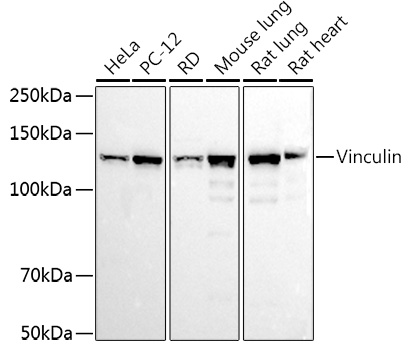Western blot analysis of various lysates using Vinculin Rabbit pAb at 1:1000 dilution. Secondary antibody: HRP-conjugated Goat anti-Rabbit IgG (H+L) at 1:10000 dilution. Lysates/proteins: 25μg per lane. Blocking buffer: 3% nonfat dry milk in TBST. Detection: ECL West Plus. Exposure time: 10s.