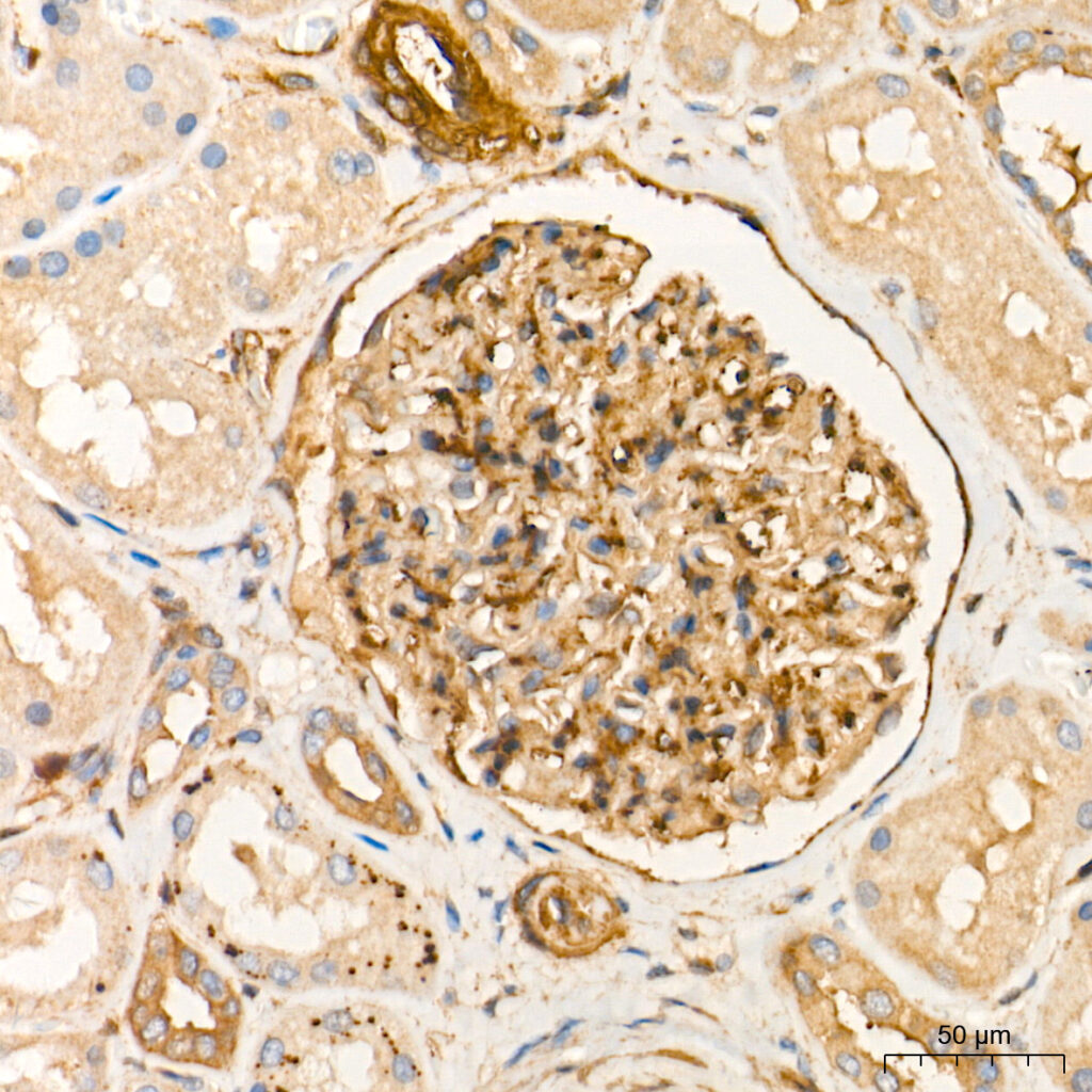 Immunohistochemistry analysis of paraffin-embedded Human kidney tissue using Vinculin Rabbit pAb at a dilution of 1:2000 (40x lens). High pressure antigen retrieval performed with 0.01M Tris-EDTA Buffer (pH 9.0) prior to IHC staining.