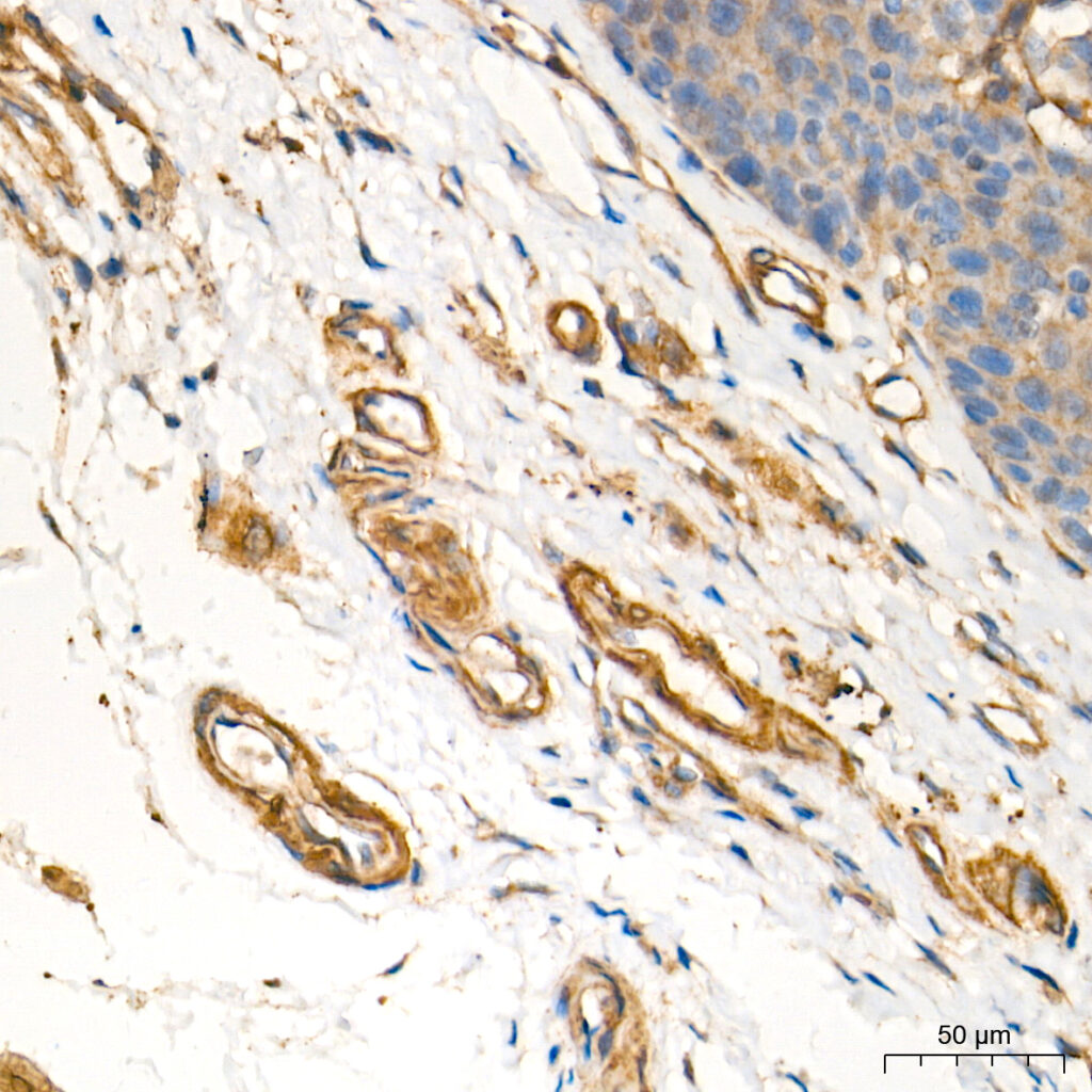 Immunohistochemistry analysis of paraffin-embedded Human esophagus tissue using Vinculin Rabbit pAb at a dilution of 1:2000 (40x lens). High pressure antigen retrieval performed with 0.01M Tris-EDTA Buffer (pH 9.0) prior to IHC staining.