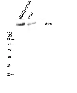 Western Blot analysis of MOUSE-BRAIN K562 cells using Atm Polyclonal Antibody diluted at 1：500