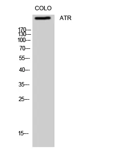 Western Blot analysis of COLO cells using ATR Polyclonal Antibody.