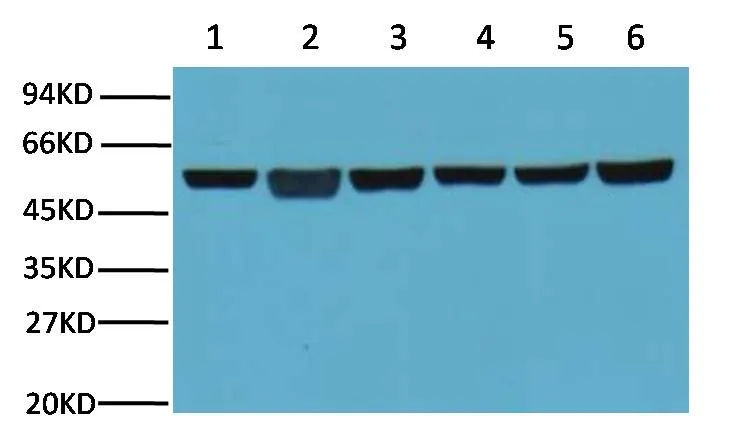 Western blot analysis of A549 (1) , Rat brain (2) ,Mouse brain (3) ,Chicken lung (4) and Rabbit testis (5),Sheep muscle (6) with β-tubulin mouse mAb(5G3) diluted at 1:5000.