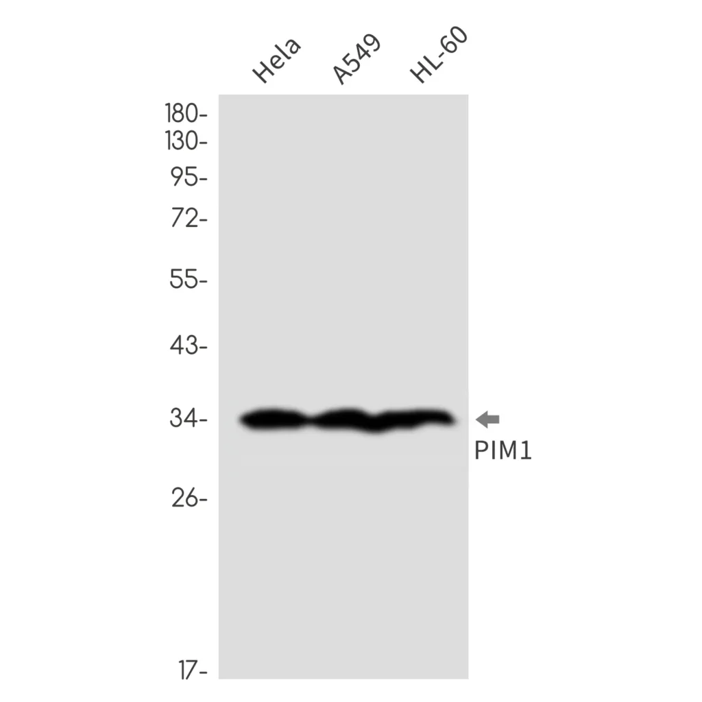 Western blot analysis of Cyclin A2 in Jurkat, C6, A431 lysates using Cyclin A2 antibody.