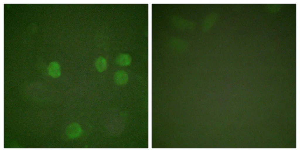 Immunofluorescence analysis of HeLa cells, using Cyclin B1 Antibody. The picture on the right is blocked with the synthesized peptide.