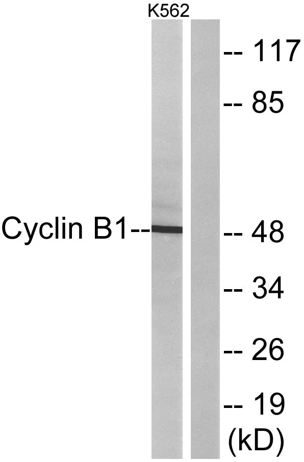Western blot analysis of lysates from K562 cells, treated with serum 10% 15', using Cyclin B1 Antibody. The lane on the right is blocked with the synthesized peptide.