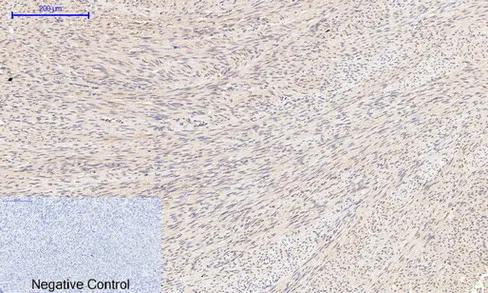 Immunohistochemical analysis of paraffin-embedded Human-uterus tissue. 1,Cyclin B1 Polyclonal Antibody was diluted at 1:200（4°C,overnight）. 2, Sodium citrate pH 6.0 was used for antibody retrieval（>98°C,20min）. 3,Secondary antibody was diluted at 1:200（room tempeRature, 30min）. Negative control was used by secondary antibody only.