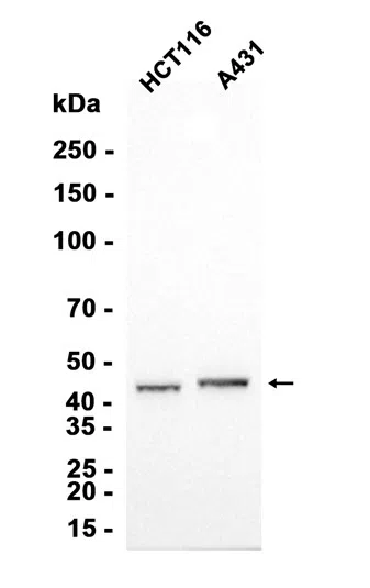Western blot analysis of extracts from HCT116，A431 cells using AMRe87634 at 1:1000.