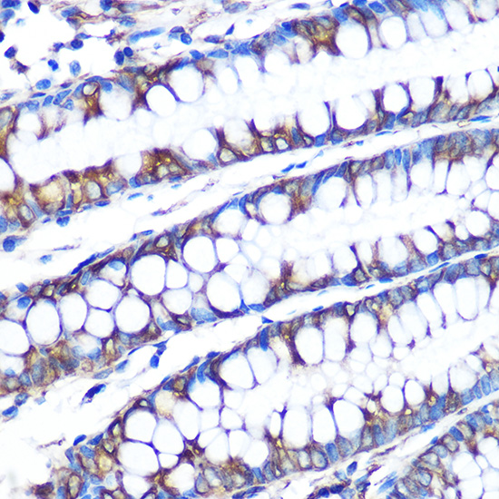 Immunohistochemistry analysis of paraffin-embedded Human colon using LOX Rabbit mAb at dilution of 1:100 (40x lens). Microwave antigen retrieval performed with 0.01M PBS Buffer (pH 7.2) prior to IHC staining.