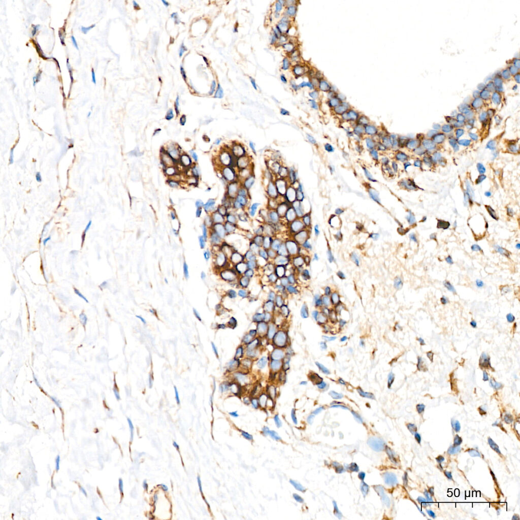 Immunohistochemistry analysis of paraffin-embedded Human breast tissue using LOX Rabbit mAb at a dilution of 1:200 (40x lens). High pressure antigen retrieval performed with 0.01M Citrate buffer (pH 6.0) prior to IHC staining.