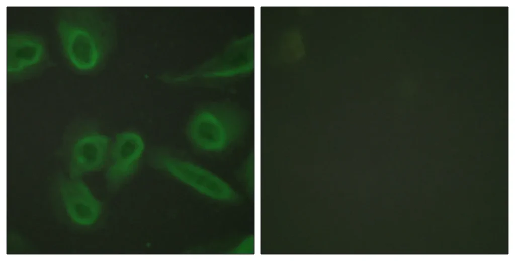 Immunofluorescence analysis of CD31 in HeLa using CD31 antibody. The picture on the right is blocked using synthesized peptide.