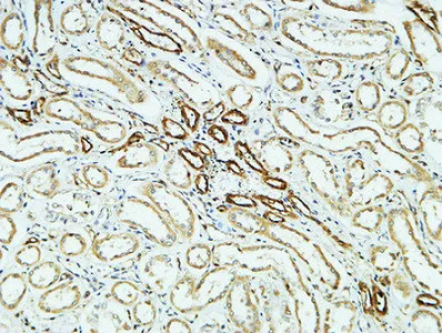 Immunohistochemistry analysis of paraffin-embedded CD31 in paraffin-embedded Human kidney using CD31 antibody. High-pressure and temperature Sodium Citrate pH 6.0 was used for antigen retrieval.