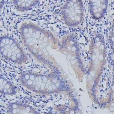 IHC-P analysis of colon tissue by PDE5A antibody
