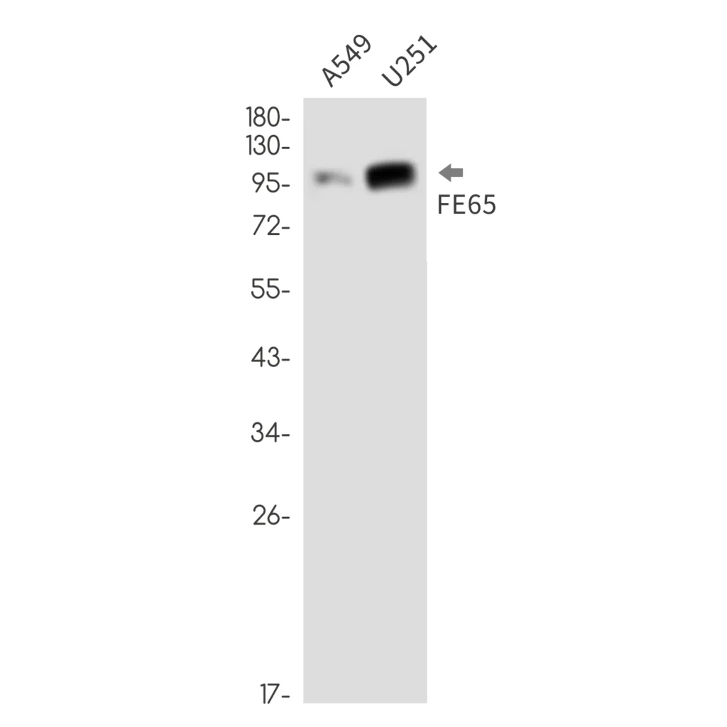 Western blot analysis of FE65 in A549, U251 lysates using FE65 antibody.