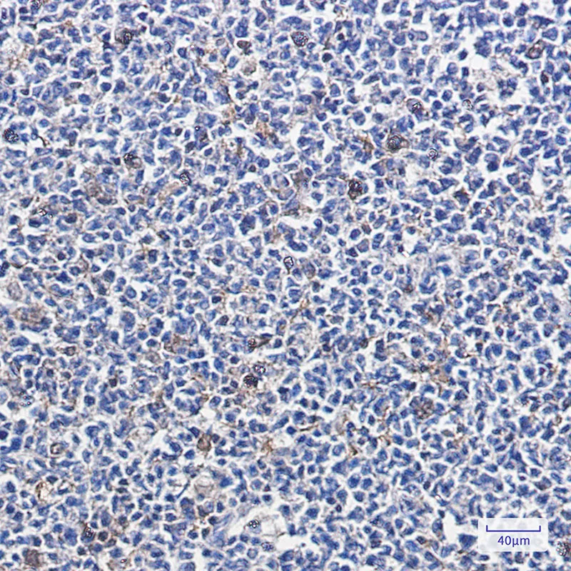 Immunohistochemistry analysis of paraffin-embedded Human tonsil using PARK7/DJ1 antibody. High-pressure and temperature Sodium Citrate pH 6.0 was used for antigen retrieval.