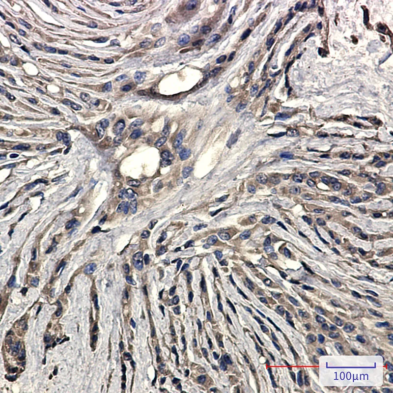 Immunohistochemistry analysis of paraffin-embedded Human Brain using Synaptophysin antibody. High-pressure and temperature Sodium Citrate pH 6.0 was used for antigen retrieval.
