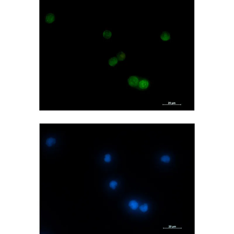 Immunocytochemistry analysis of VAMP2 (green) in Jurkat using VAMP2 antibody, and DAPI (blue).
