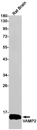 Western blot analysis of VAMP2 in rat Brain lysates using VAMP2 antibody